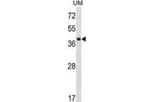 Western blot analysis in UM cell line lysates (35ug/lane) using SPOPL  Antibody . (SPOPL anticorps  (Middle Region))