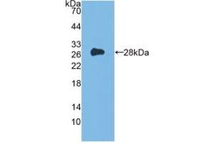 Figure. (FLT3 anticorps  (AA 335-544))