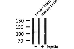 Western blot analysis of extracts from mouse brain, using IFIH1 Antibody. (IFIH1 anticorps  (C-Term))