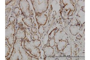 Immunoperoxidase of monoclonal antibody to SOCS5 on formalin-fixed paraffin-embedded human small Intestine.