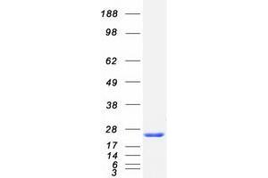 Validation with Western Blot