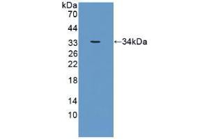 Western blot analysis of recombinant Human CRAT. (CRAT anticorps  (AA 363-626))