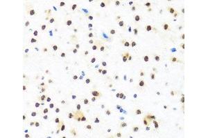 Immunohistochemistry of paraffin-embedded Mouse brain using FUBP1 Polyclonal Antibody at dilution of 1:100 (40x lens).