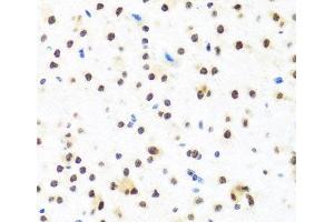 Immunohistochemistry of paraffin-embedded Mouse brain using FUBP1 Polyclonal Antibody at dilution of 1:100 (40x lens). (FUBP1 anticorps)