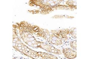 Immunohistochemistry of paraffin embedded rat colon using ATP1A1 (ABIN7073154) at dilution of 1: 500 (400x lens) (ATPase (Na/K) anticorps)