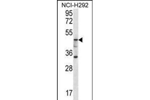 GBA3 Antibody (C-term) (ABIN656223 and ABIN2845539) western blot analysis in NCI- cell line lysates (35 μg/lane). (GBA3 anticorps  (C-Term))