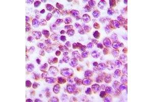 Immunohistochemistry (IHC) image for anti-Nuclear Factor of Activated T-Cells, Cytoplasmic, Calcineurin-Dependent 1 (NFATC1) antibody (ABIN7308080)