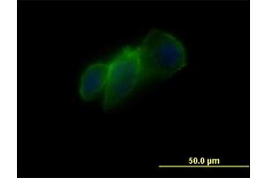 Immunofluorescence of monoclonal antibody to CDH11 on PC3-MM2 cell.