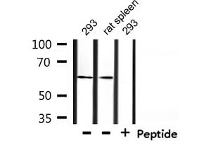 Western blot analysis of extracts from 293 and rat spleen, using TAF15 Antibody.