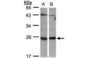 WB Image Sample(30 ug whole cell lysate) A:293T B:Hep G2 , 12% SDS PAGE antibody diluted at 1:1000 (ITPA anticorps)