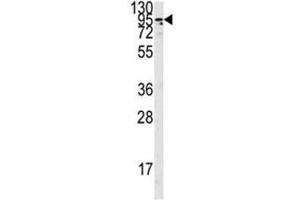 Western blot analysis of the Angiotensin-converting enzyme 2 antibody in K562 lysate.