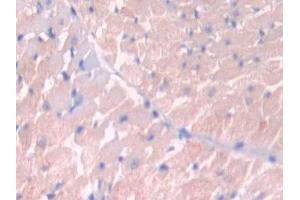 Detection of JAK2 in Rat Heart Tissue using Polyclonal Antibody to Janus Kinase 2 (JAK2)