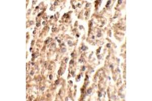 Immunohistochemistry (IHC) image for anti-Angiopoietin 2 (ANGPT2) (C-Term) antibody (ABIN1030235) (Angiopoietin 2 anticorps  (C-Term))