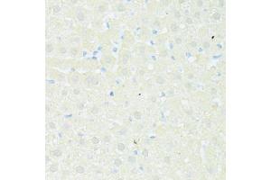 Immunohistochemistry of paraffin-embedded rat liver using TRIM15 antibody (ABIN5999102) at dilution of 1/100 (40x lens). (TRIM15 anticorps)