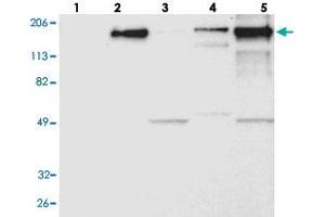Western blot analysis of Lane 1: RT-4, Lane 2: U-251 MG, Lane 3: A-431, Lane 4: Liver, Lane 5: Tonsil with LAMB2 polyclonal antibody . (LAMB2 anticorps)