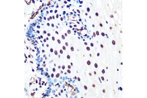 Immunohistochemistry of paraffin-embedded human esophageal using Ku80 Rabbit mAb (ABIN7271406) at dilution of 1:100 (40x lens).