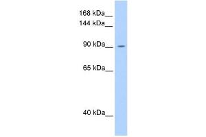 OSMR antibody used at 1 ug/ml to detect target protein. (Oncostatin M Receptor anticorps  (N-Term))