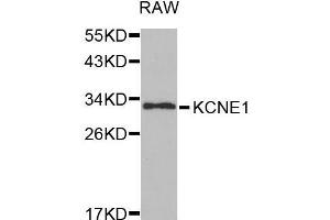 Western blot analysis of extracts of RAW cell line, using KCNE1 antibody. (KCNE1 anticorps  (AA 1-100))