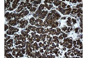 Immunohistochemistry (IHC) image for anti-Hydroxysteroid (17-Beta) Dehydrogenase 8 (HSD17B8) (AA 57-261) antibody (ABIN2715557) (HSD17B8 anticorps  (AA 57-261))