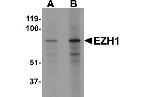 Western blot analysis of EZH1 in mouse lung tissue lysate with EZH1 antibody at (A) 1 and (B) 2 µg/mL (EZH1 anticorps  (N-Term))