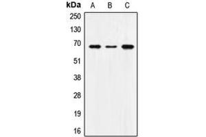 Western blot analysis of SNX1 expression in MCF7 (A), SP2/0 (B), H9C2 (C) whole cell lysates. (Sorting Nexin 1 anticorps  (Center))