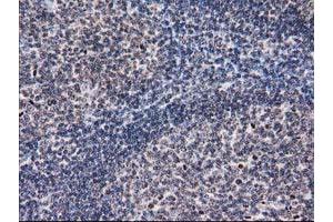 Immunohistochemical staining of paraffin-embedded Human lymph node tissue using anti-EIF1 mouse monoclonal antibody. (EIF1 anticorps)