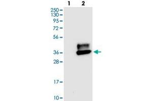Western blot analysis of Lane 1: Negative control (vector only transfected HEK293T lysate), Lane 2: Over-expression Lysate (Co-expressed with a C-terminal myc-DDK tag (~3. (CEACAM1 anticorps)
