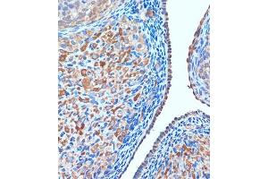 Immunohistochemistry of paraffin-embedded Rat ovary using TCIRG1 Rabbit pAb (ABIN7270707) at dilution of 1:100 (40x lens).