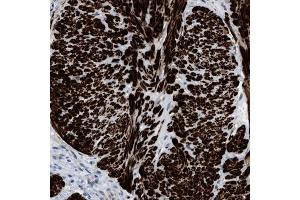 Immunohistochemical staining (Formalin-fixed paraffin-embedded sections) of human gallbladder shows strong cytoplasmic positivity in smooth muscle cells. (Transgelin anticorps  (AA 19-94))