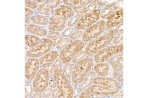 Immunohistochemistry of paraffin-embedded mouse kidney using NDUFS1 Rabbit pAb (ABIN7268819) at dilution of 1:50 (40x lens). (NDUFS1 anticorps  (AA 80-290))