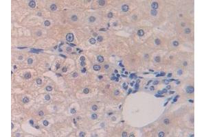 Detection of ZBP1 in Human Liver Tissue using Polyclonal Antibody to Z-DNA Binding Protein 1 (ZBP1)