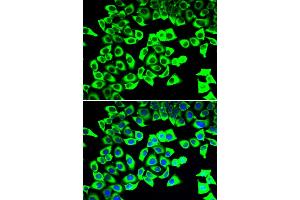 Immunofluorescence analysis of U2OS cells using RPLP2 antibody. (RPLP2 anticorps)