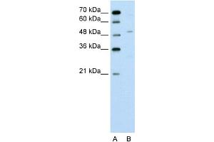 WB Suggested Anti-ZNF19 Antibody Titration:  0. (ZNF19 anticorps  (N-Term))