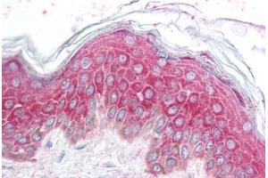 Human Skin (formalin-fixed, paraffin-embedded) stained with AVEN antibody ABIN213902 at 5 ug/ml followed by biotinylated goat anti-rabbit IgG secondary antibody ABIN481713, alkaline phosphatase-streptavidin and chromogen. (AVEN anticorps  (N-Term))