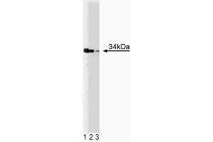 Western blot analysis of TRADD on a Jurkat cell lysate (Human T-cell leukemia, ATCC TIB-152). (TRADD anticorps  (AA 163-312))