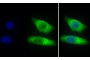 Detection of CTSZ in Human Hela cell using Polyclonal Antibody to Cathepsin Z (CTSZ) (Cathepsin Z anticorps  (AA 24-303))