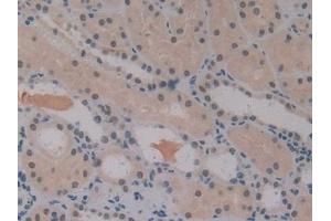 Detection of IGFBP1 in Human Kidney Tissue using Polyclonal Antibody to Insulin Like Growth Factor Binding Protein 1 (IGFBP1)