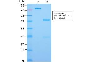 SDS-PAGE Analysis Purified CDX2 Rabbit Recombinant Monoclonal Antibody (CDX2/2951R). (Recombinant CDX2 anticorps  (AA 150-249))