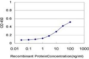 Detection limit for recombinant GST tagged PCAF is approximately 0.