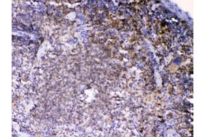 IHC testing of FFPE mouse spleen tissue with LYN antibody at 1ug/ml. (LYN anticorps  (AA 470-501))