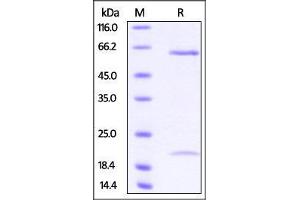 Cynomolgus PCSK9, His Tag on SDS-PAGE under reducing (R) condition.