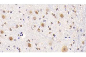 Detection of NCL in Mouse Cerebellum Tissue using Polyclonal Antibody to Nucleolin (NCL) (Nucleolin anticorps  (AA 353-568))