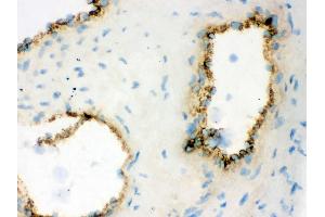 IHC analysis of VWF using anti-VWF antibody .