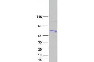 Validation with Western Blot