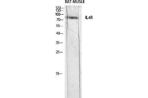 Western Blot (WB) analysis of Rat Muscle lysis using IL4R antibody.