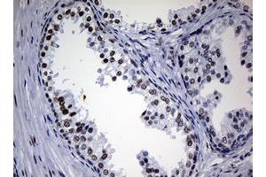 Image no. 11 for anti-Nibrin (NBN) (AA 183-460) antibody (ABIN1491059)