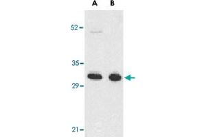Western blot analysis of TNFRSF13B in K-562 (A) and U-937 (B) cell lysates with TNFRSF13B polyclonal antibody  at 5 ug/mL . (TACI anticorps  (N-Term))