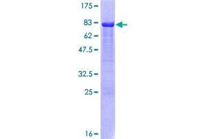 Image no. 1 for Interferon Regulatory Factor 3 (IRF3) (AA 1-427) protein (GST tag) (ABIN1308084)