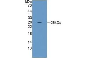 Detection of Recombinant PRSS1, Human using Polyclonal Antibody to Protease, Serine 1 (PRSS1) (PRSS1 anticorps  (AA 51-228))