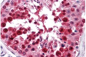 Human Testis: Formalin-Fixed, Paraffin-Embedded (FFPE)